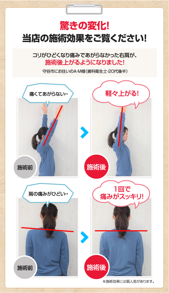 驚きの変化!当店の施術効果をご覧ください!