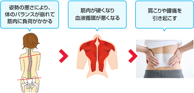 姿勢の悪さが関係して起こる症状